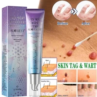 effective warts remover ointment remove skin tag cream painless treatment neck armpits genital flat wart foot corn skin care 20g