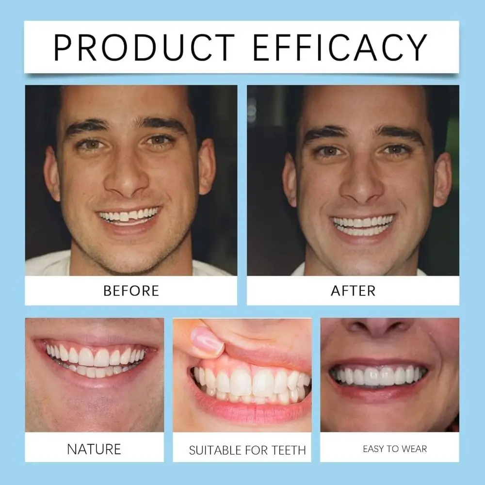 Силиконовый набор для облегчения зубных протезов. Мягкий безопасный и прочный.