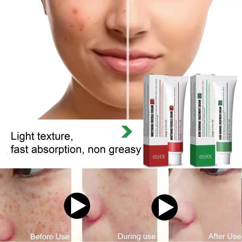 

Whitening Cream Face Freckle Remove Dark Spots Fade Acne Scar Removal Pigmentation Melasma Anti-Aging Brighten Skin Repair Cream