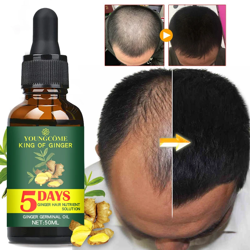 

Hair Growth Products Ginger Fast Growing Hair Essential Oil Beauty Hair Care Prevent Hair Loss Oil Scalp Treatment For Men Women