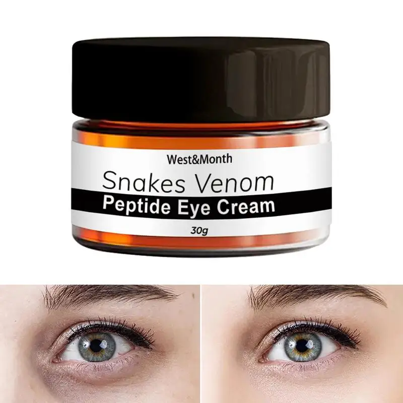 

30g Anti Age Hydrating Eye Repair Skin Barrier For Dark Circles Under Eyes Puffiness Moisturizing Whitening Anti-Fine Lines