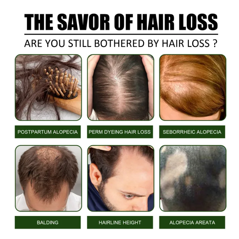 Эссенция для быстрого роста волос спрей мужчин женщин предотвращения выпадения