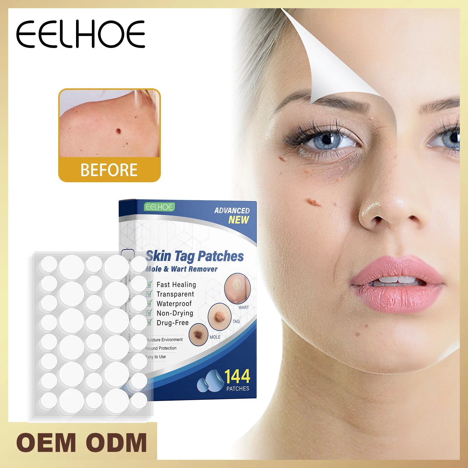 

144pcs/box Acne Wart Remover Pimple Wart Treatment Patch Hydrocolloid Gel Anti-infection Invisible Skin Tag Sticker Face Care