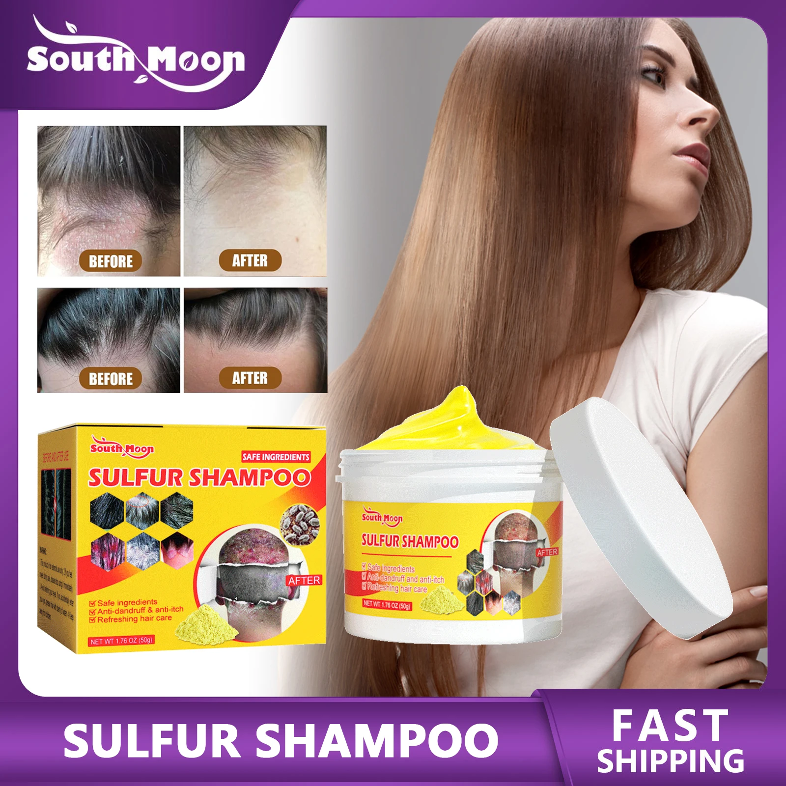 

Sulfur Shampoo Remove Lice Mites Dandruff Itching Oil Control Antipruritic Deep Cleaning Hair Follicles Nourishing Scalp Care