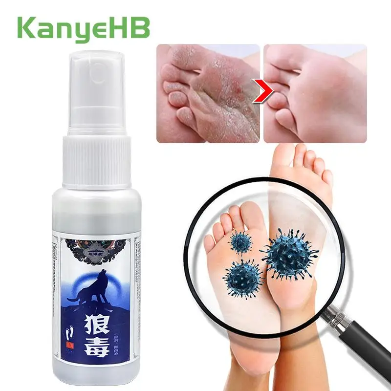 

1Pcs Foot Odor Beriberi Spray Fungus Inhibitor Spray Feet Anti-itch Treat Psoriasis Athlete Foot Peeling Remove Tinea Pedis S089
