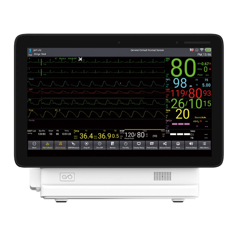 

Nibp Spo2 Patient Monitor Touch Screen Medical Diagnostic Portable Vital Signs Multi-parameter Patient Monitor