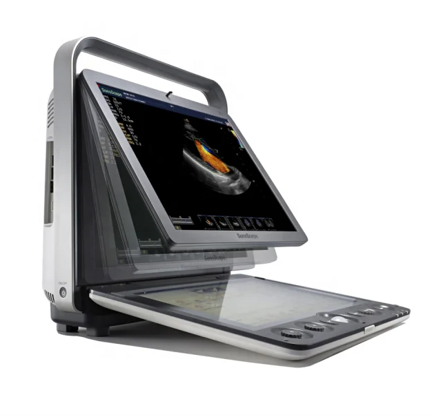 

Ультразвуковая машина Sonoscape S9/портативное цветное 3D 4D ультразвуковое устройство, совместимое с кардиозондом