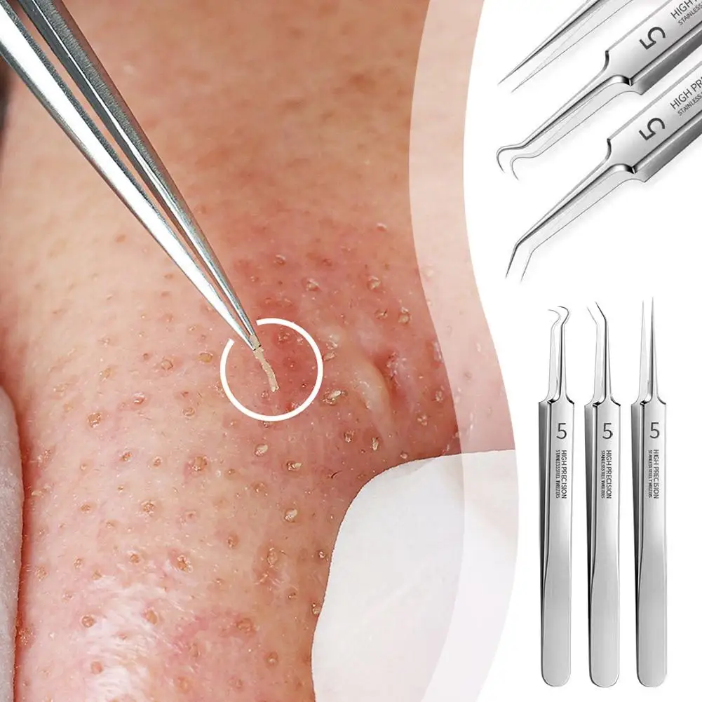 

Ultra-fine Cell Pimples Blackhead Clip Tweezers Beauty Face Acne Blackhead Health Tool Needle Special Salon Remover O2V9