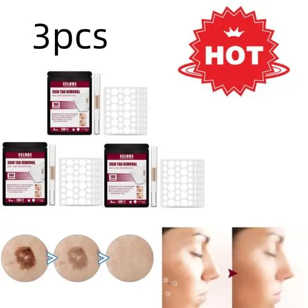 

3 шт., нетоксичные резинки для удаления родинок, бородавок