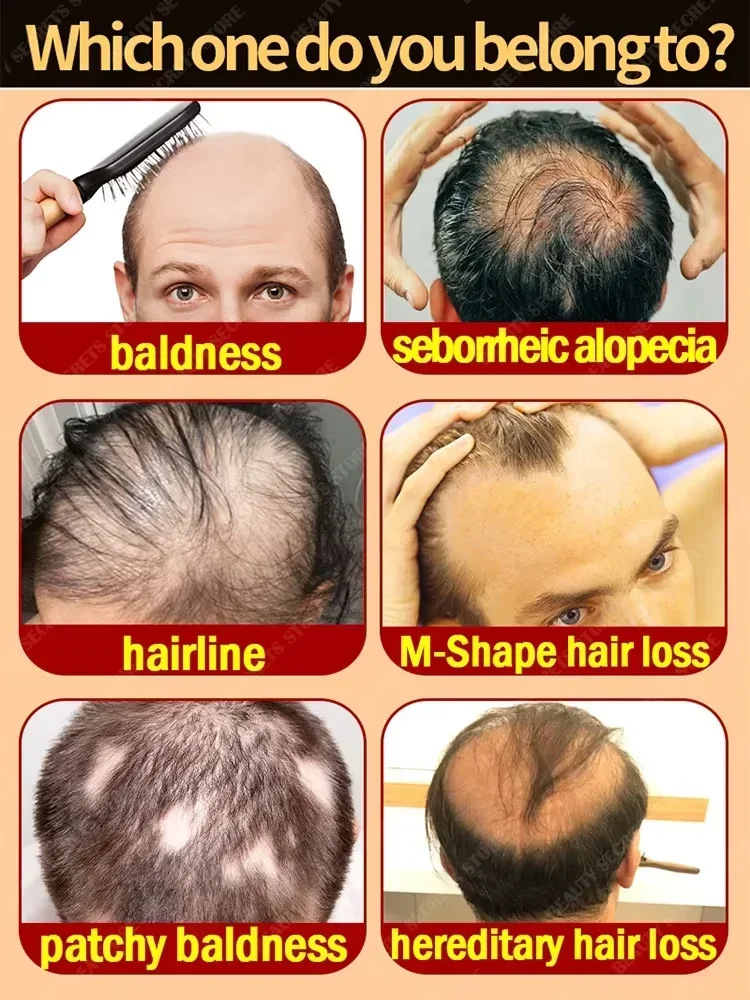 Óleo de crescimento rápido do cabelo para produtos homens mulheres
