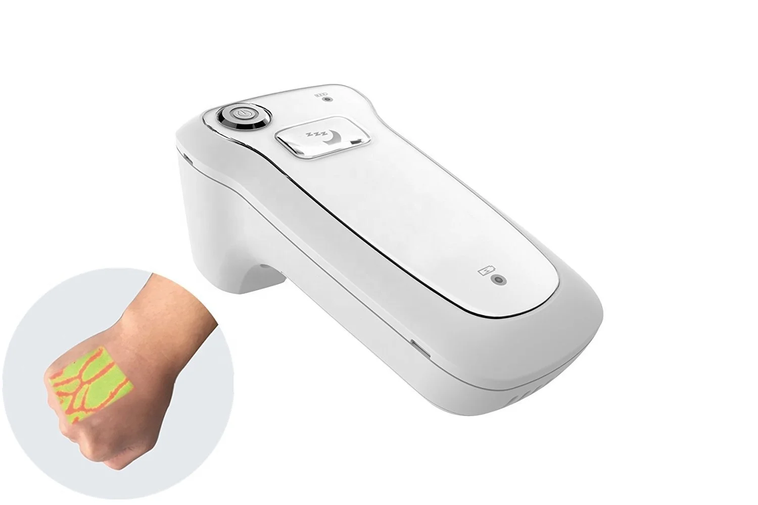 обнаружение вен