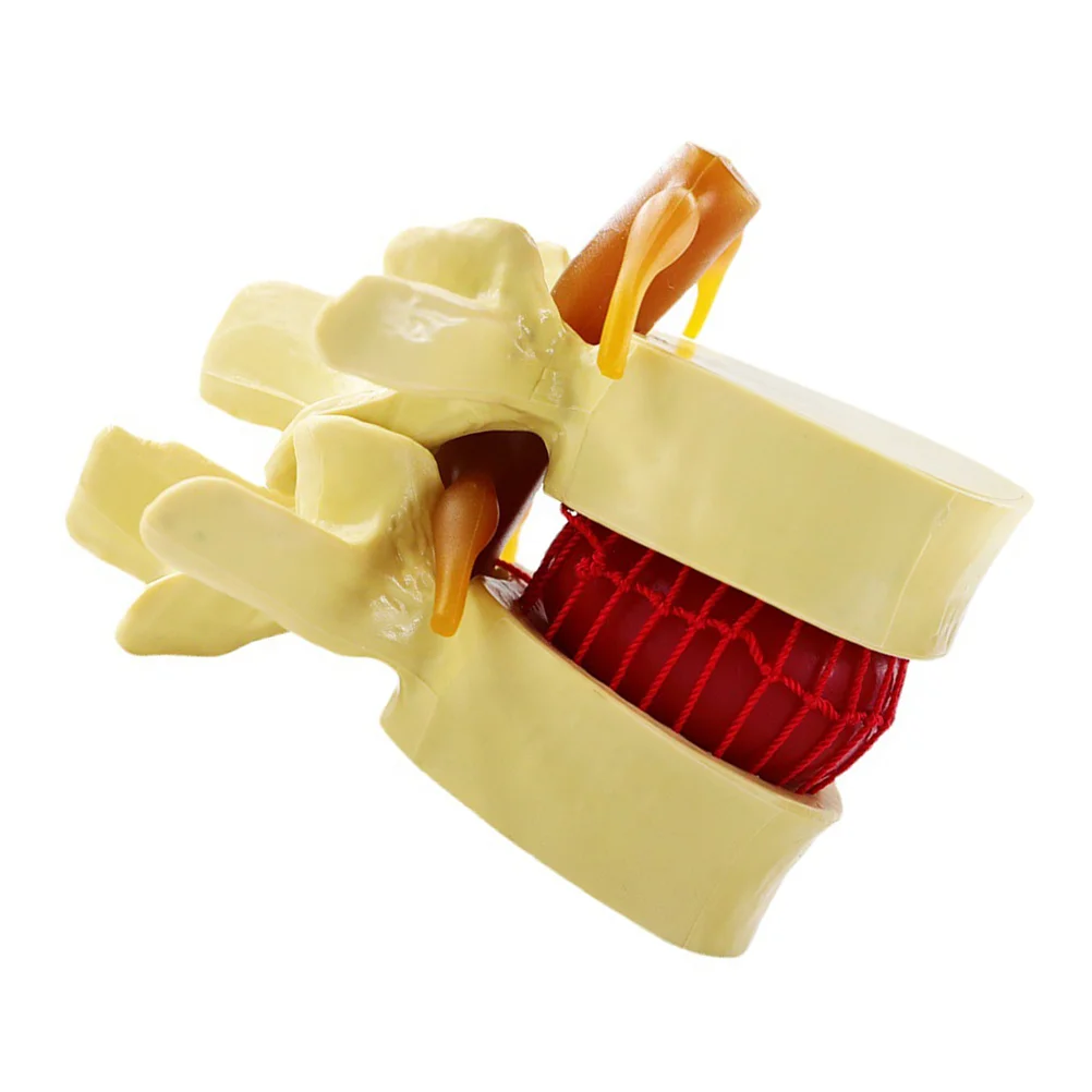 

Model Spine Lumbar Herniation Disc Human Models Anatomical Vertebrae Anatomy Vertebral Teaching Intervertebral Chiropractic