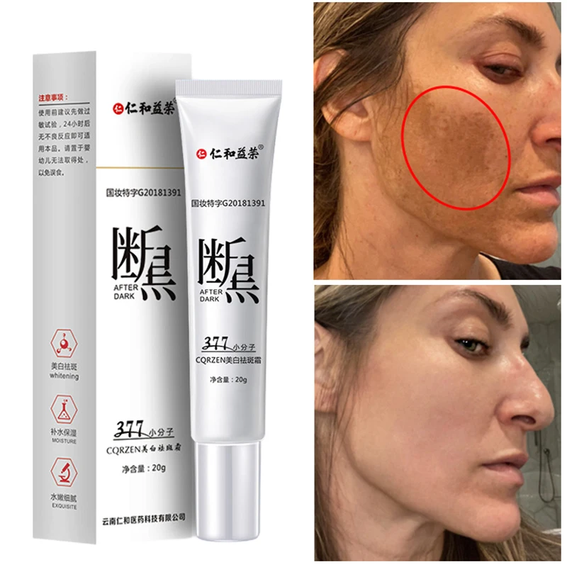 Whitening Cream Remove Face Spots Blemish Freckle Melanin Against Black Dot Rejuvenating Cream Moisturizing Korean Cosmetics 20g