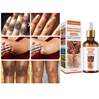 dark knees and elbows lightening serum dark spots cream body oil blanqueadora body oil shunga free shipping