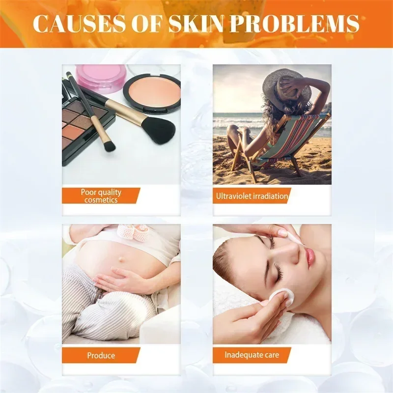 Удаление веснушек Папайя Дневной ночной крем Эффективная коррекция темных пятен