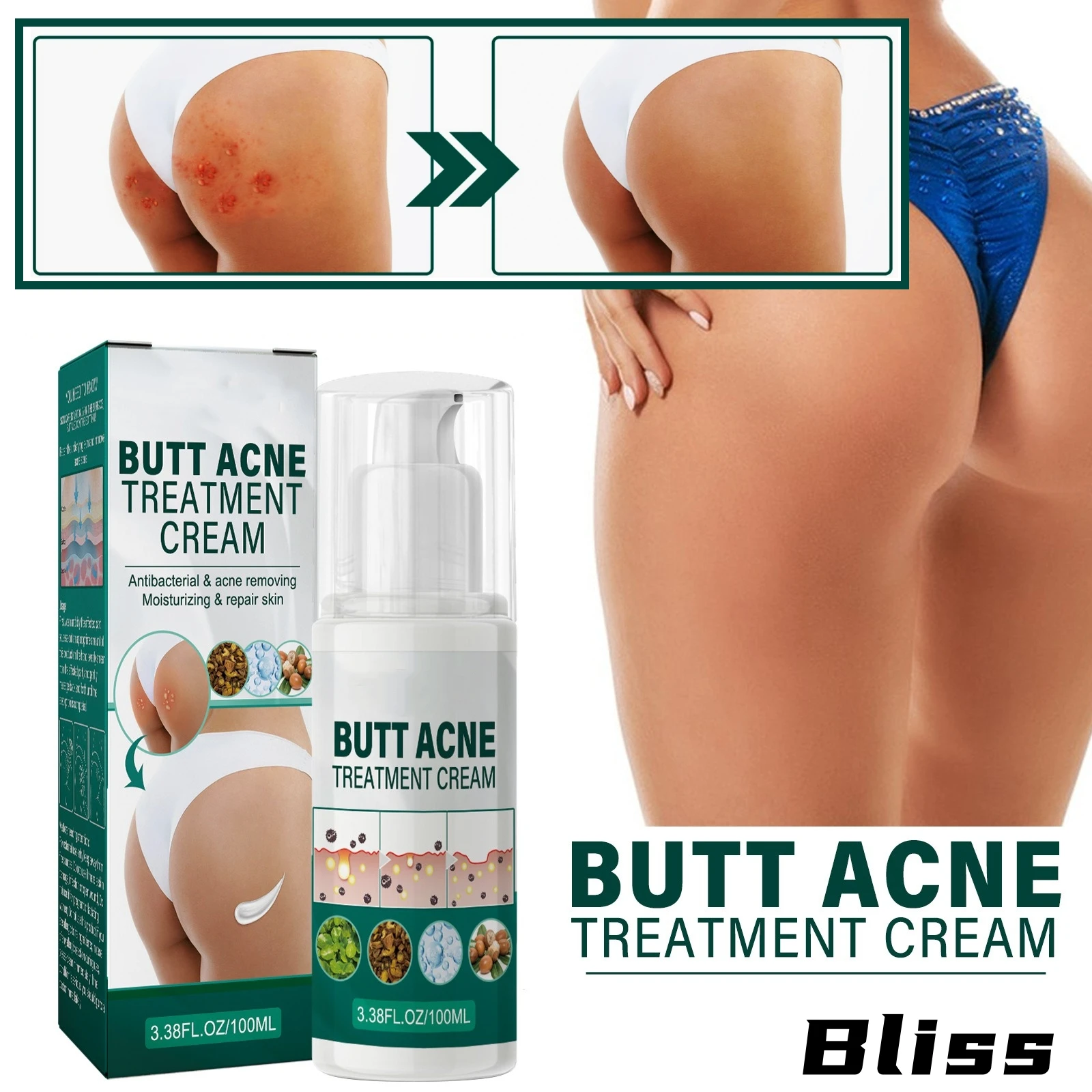 Осветляющий крем для тела тусклый увлажняющий лосьон ягодиц и внутренней части