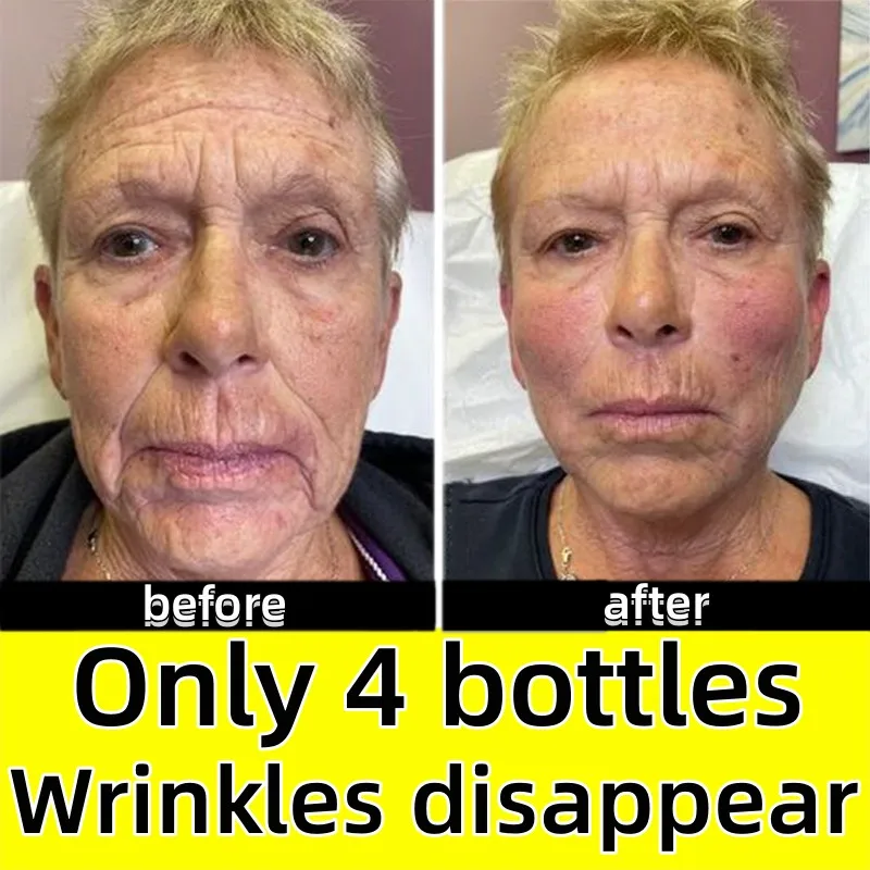 

Anti-aging wrinkle-removing facial serum to eliminate facial wrinkles, fine lines around the eyes, crow's feet and neck wrinkles