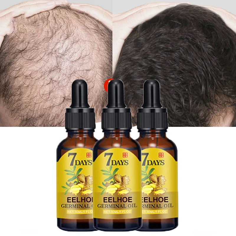 3 шт. эфирное масло для роста волос против выпадения |