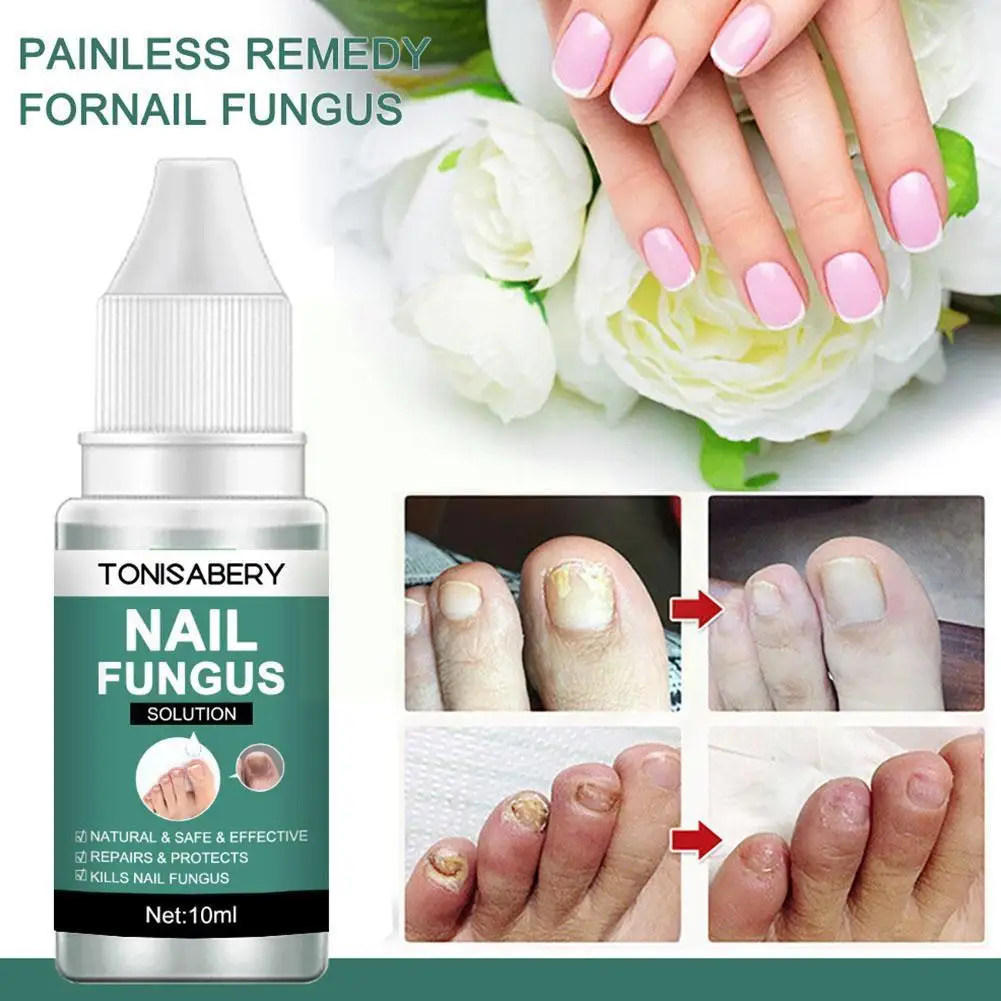 

Nail Fungal Treatment Feet Care Essence Anti Infection Fungus Product 10ml Onychomycosis Foot Paronychia Toenail Nail Remov S7G2