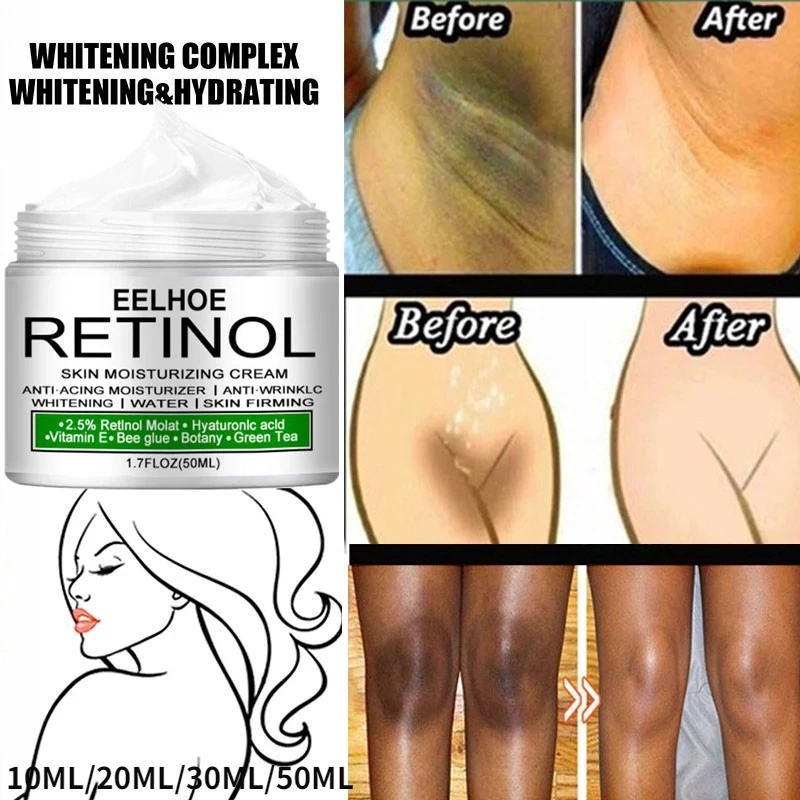

Body Whitening Cream Private Parts Underarm Bleaching Remove Melanin Serum Whiten Butt Knee Brighten Inner Thigh Intimate Cream