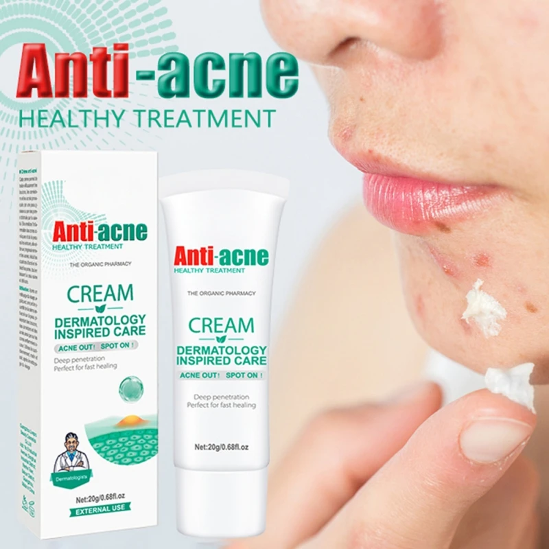 

20g Anti Acne Face Body Creams Gel Freckles Wart Removal Spot Removal Oil Control Nair Repair Fine Pores Roughness Brighten Care