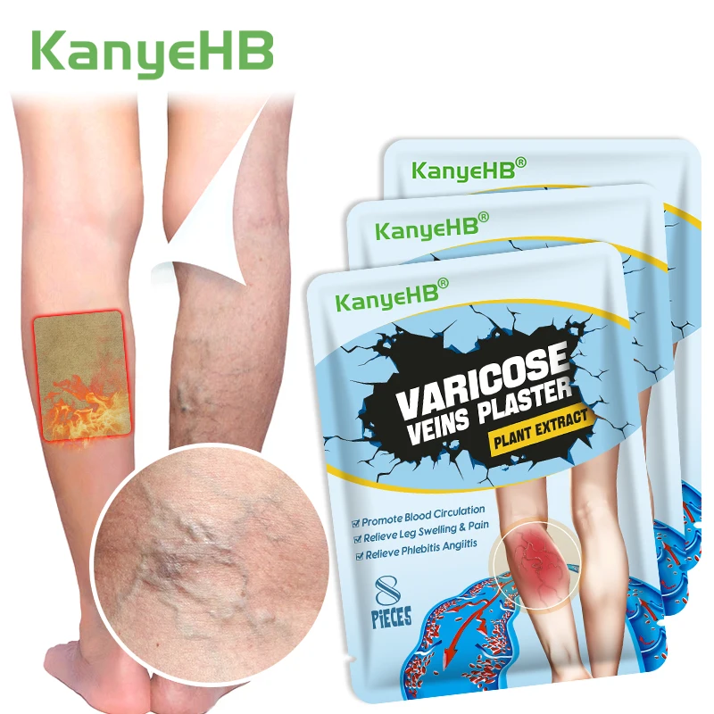 

8/24/40Pcs Hebal Varicose Veins Plaster Vasculitis Phlebitis Removal Spider Veins Leg Chinese Medical Veins Pain Relief Patch