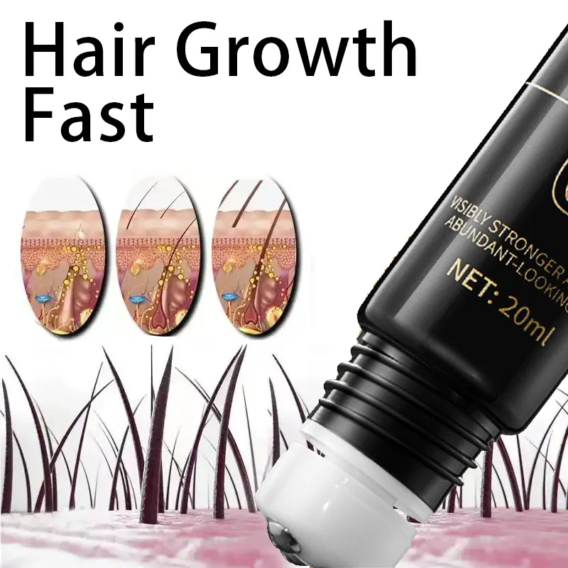 

Эффективная Сыворотка против выпадения волос, средство для восстановления облысения, уход за волосами после родов