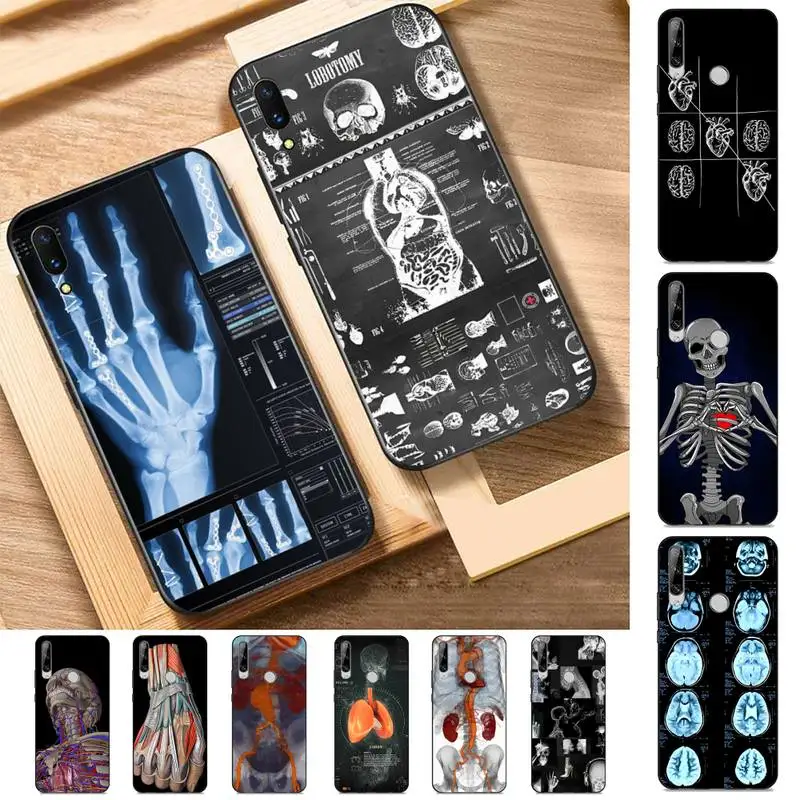 

Radiological Human Organs Skeleton Skull Phone Case for Huawei Y 6 9 7 5 8s prime 2019 2018 enjoy 7 plus