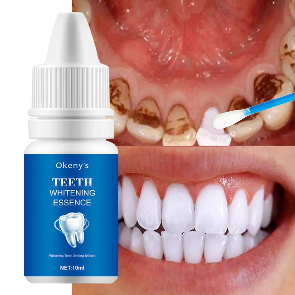

Teeth Whitening Essence Powder Clean Oral Hygiene Whiten Teeth Remove Plaque Stains Fresh Breath Oral Hygiene Dental Tools