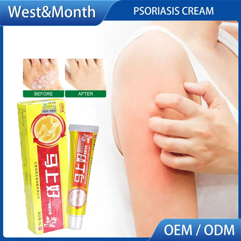 

Treatment Skin Problems Dermatitis Antibacterial Skin Eczematoid Ointments Psoriasis Cream 15g