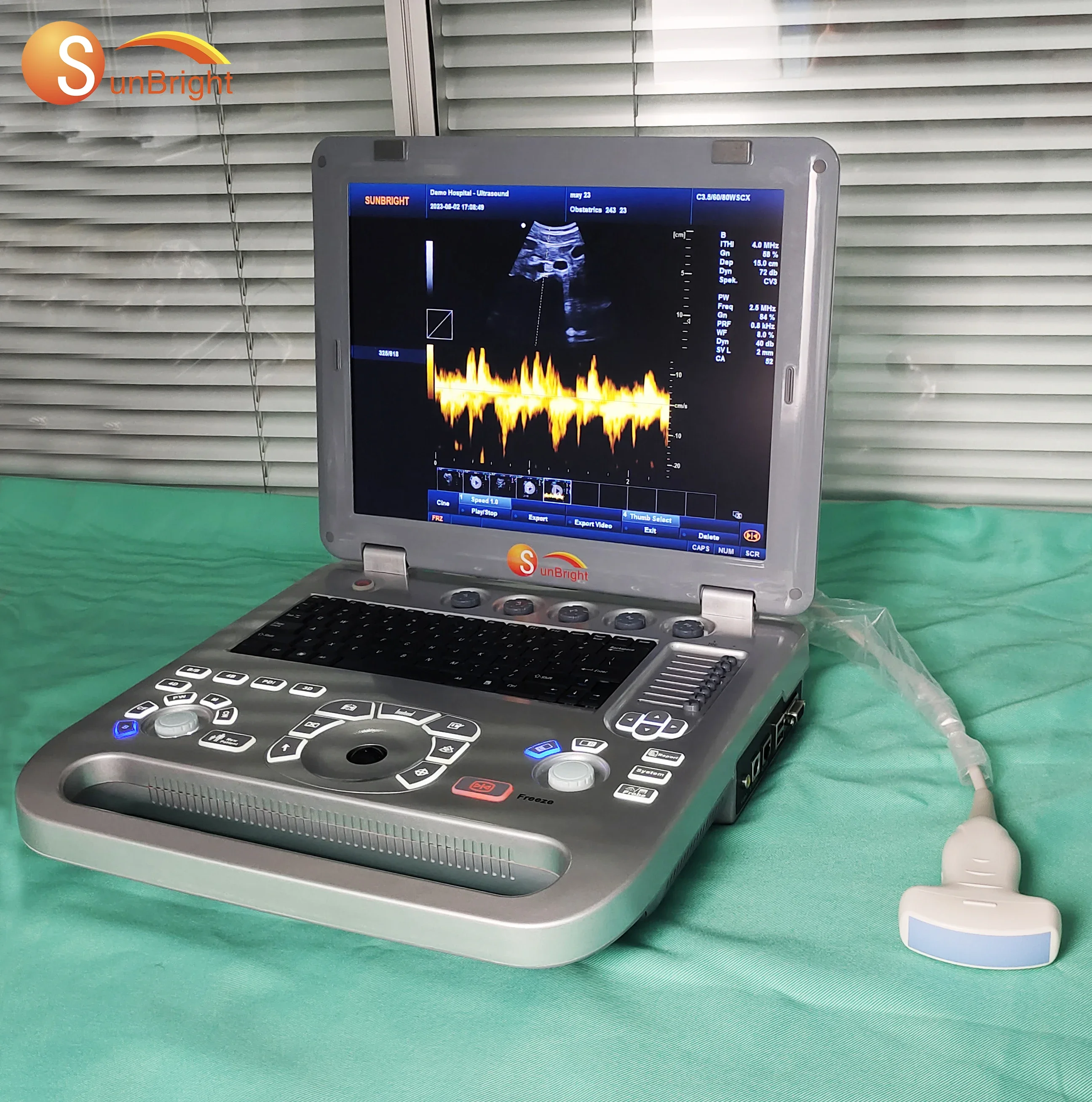 SUN-800F2 Medical ecografo портативный профессиональный акушерский ноутбук ультразвуковой