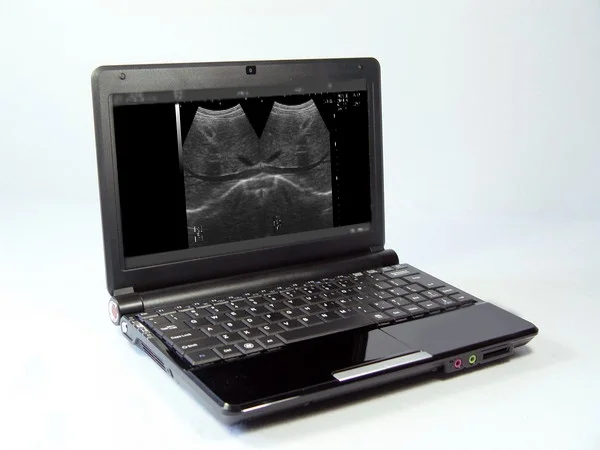 

Pig Sheep Portable LCD VET Digital laptop ultrasound machines for cow pregnancy test