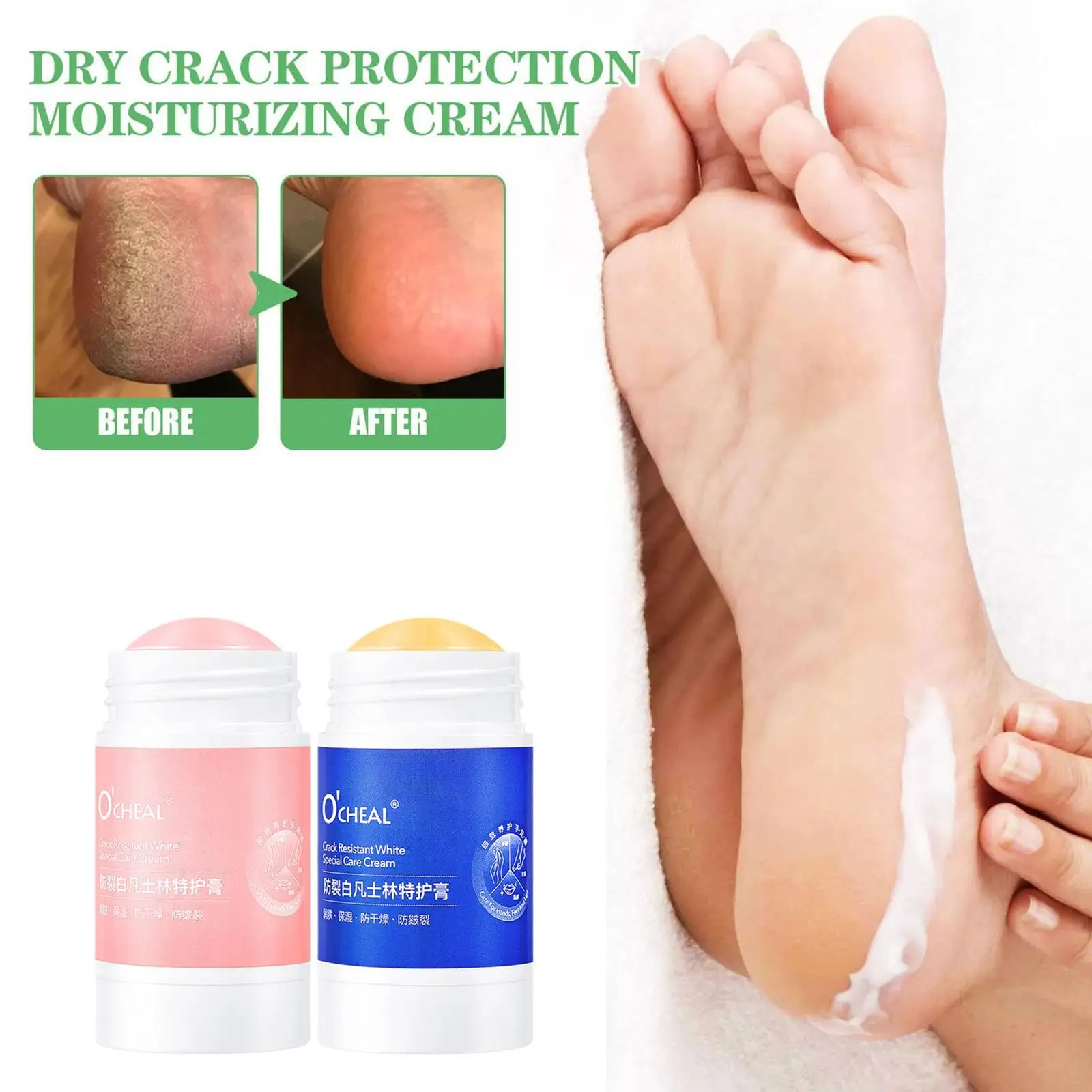 

1PCS Ocheal Anti-Drying Crack Foot Cream Hand Cracked Repair Cream Removal Dead Skin Hand Feet Care Skin Hot