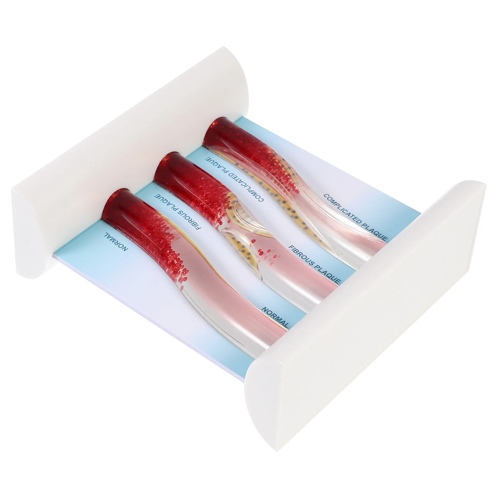 

Dynamic Blood Lipid Vascular Mannequins LDL Anatomical Mannequins Blood Vessel Mannequins