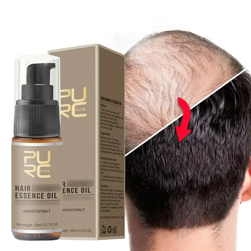 

Ginger Oil For Hair Growth Hair Growth Serums 20ml Ginger Hair Growth Oil For Thinning/Balding /Repairs Hair Follicles /Promotes