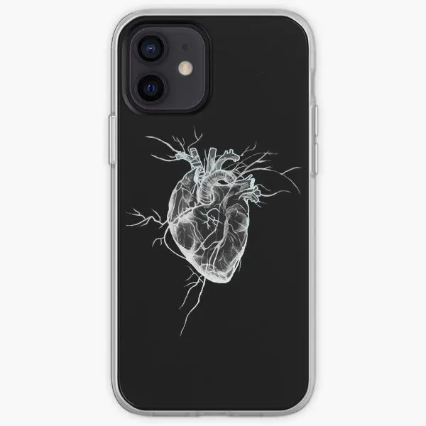 

Чехол для iPhone X XS XR Max 11 12 13 14 Pro Max Mini 6 6S 7 8 Plus