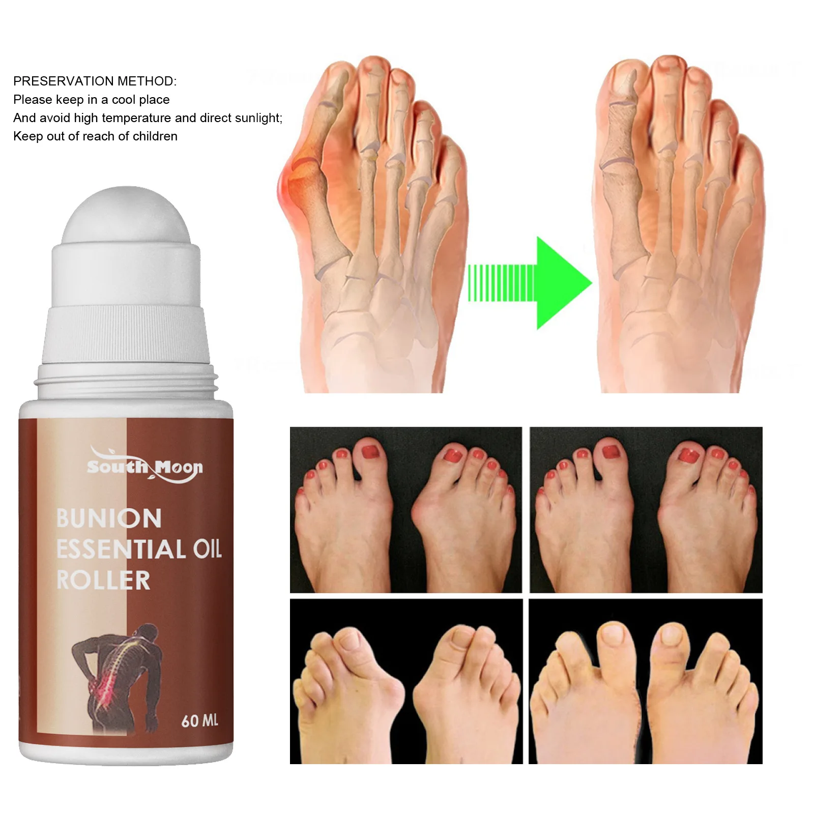 South Moon 1/2/3cps 60ml Bunion Essential Oil Roller Correct Thumb Valgus Pain Relief Foot Care Handy Free Shipping