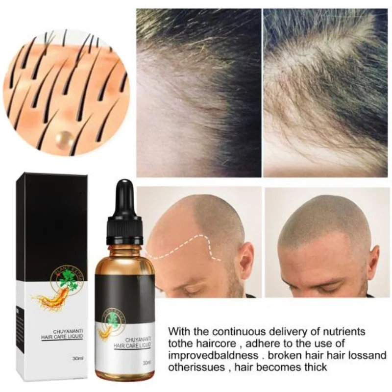 

Repair Damaged Hair Restore Luster Safe Ginger Soften Hair Scalp Care Growth Liquid for Unisex Natural Beauty Hair Care