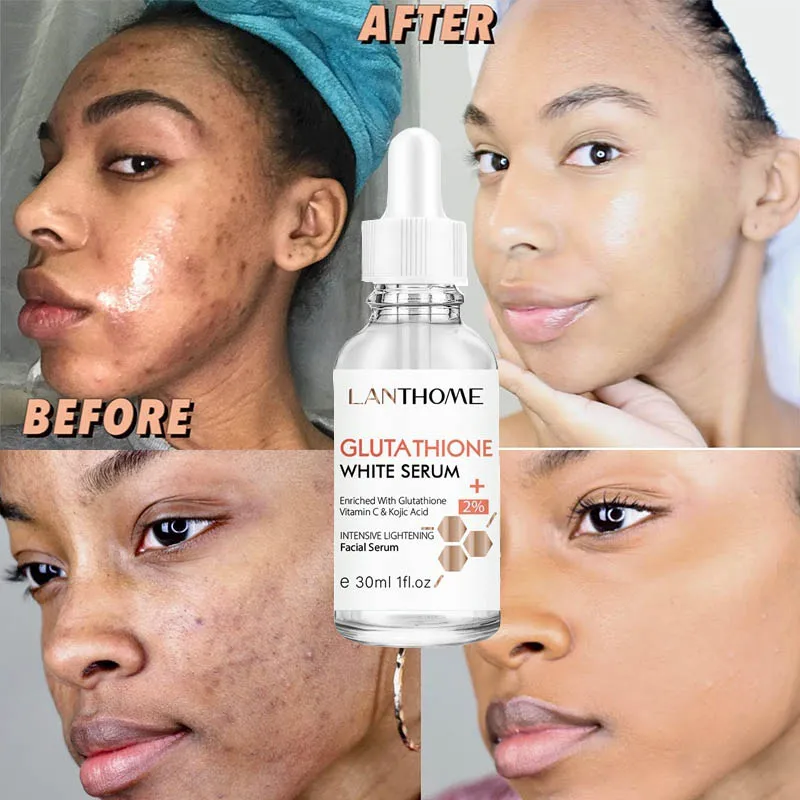

Glutathione Whitening Freckle Face Serum Remove Dark Spots Melasma Lighten Melanin Fade Acne Scars Anti-Aging Brighten Skin Care