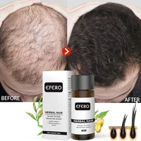 ginger hair growth products natural anti hair loss prevent baldness treatment fast growing nourish dry damaged hair care