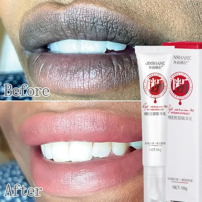 

Pink Lips Fresh Bleaching Lip Balm Treatment Remove Dark Smoke Lips Dilute Melanin Whitening Moisturizer Nourish Essence Cream