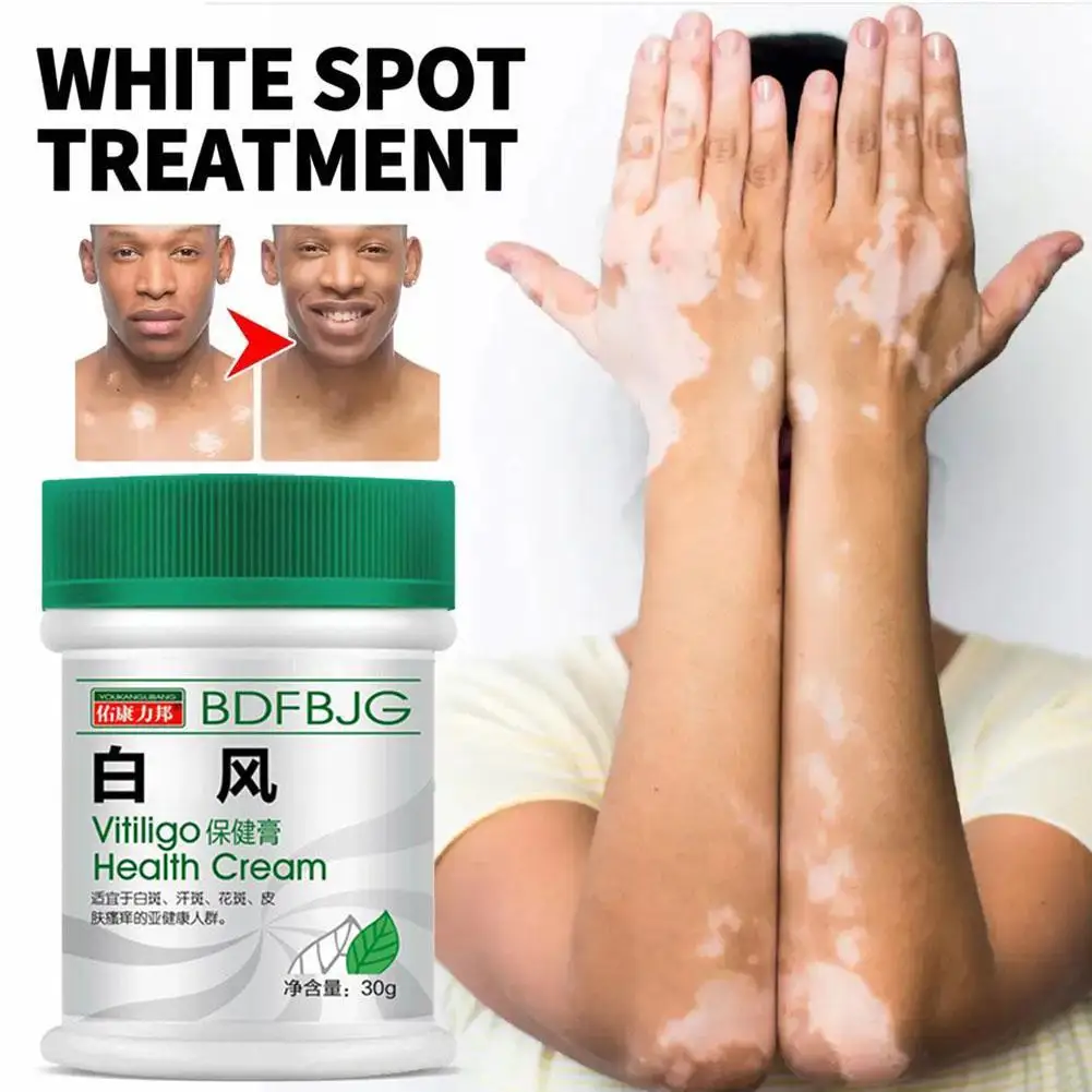

Vitiligo Fix Revitalize Elixir Vitiligo Treatment CreamTreat Vitiligo Soothing Cream Body Vitiligo Care Cream Reduce White Spot