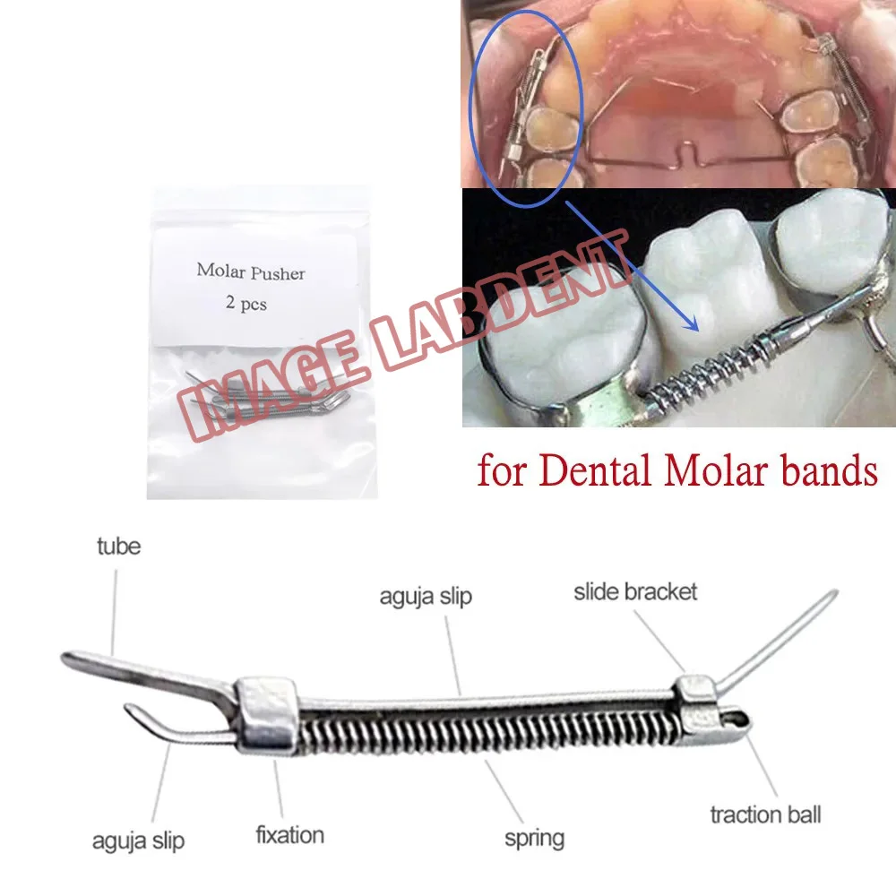 2 шт./упаковка зубные ортодонтические молярные Толкатели