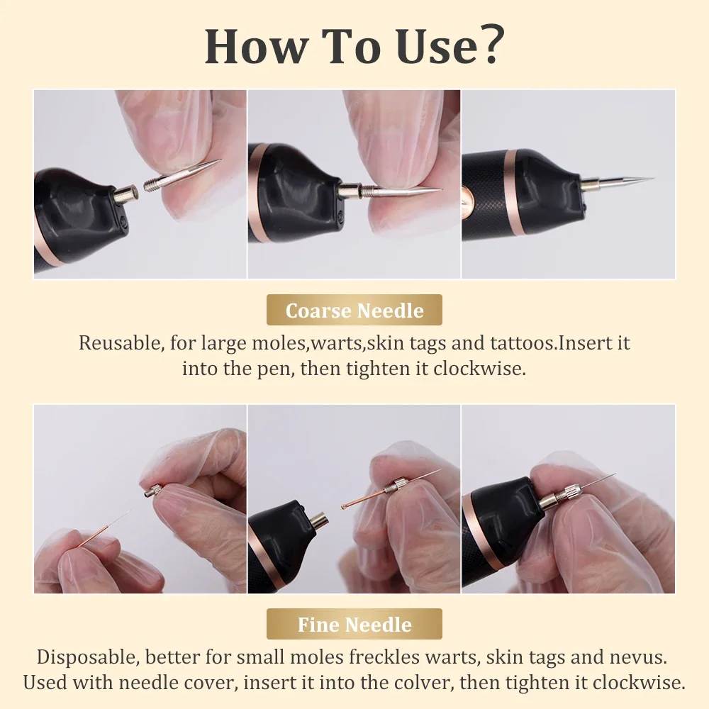 Плазменное удаление бородавок кожи лица электрическое приспособление папилломы