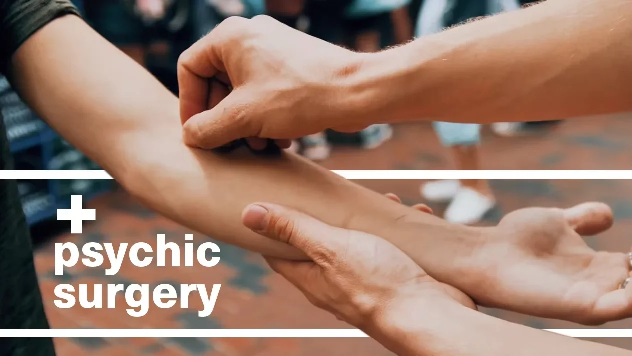 Психологическая хирургия Аарона Александра - Фокусы