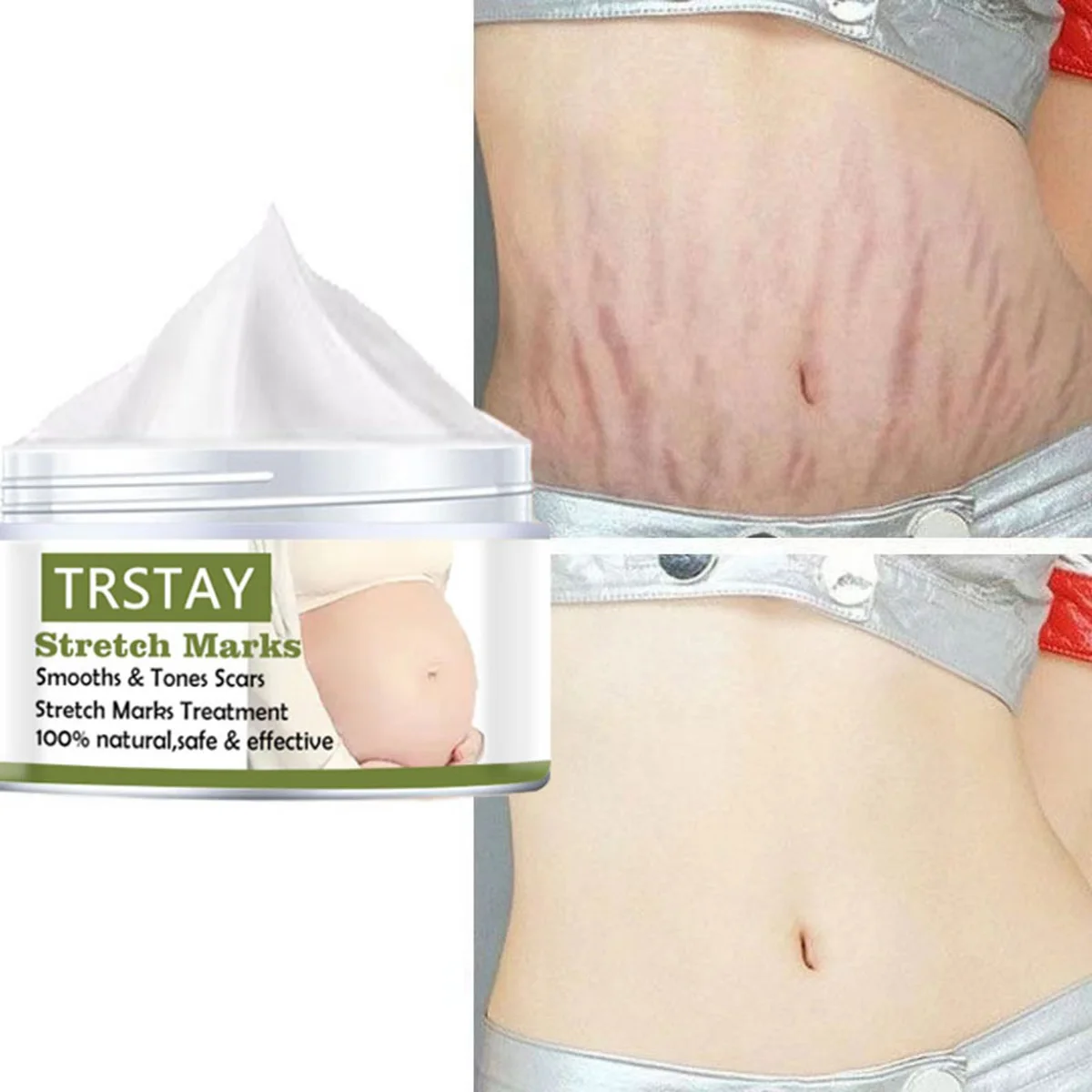 Восстанавливающий крем для линии живота беременных женщин