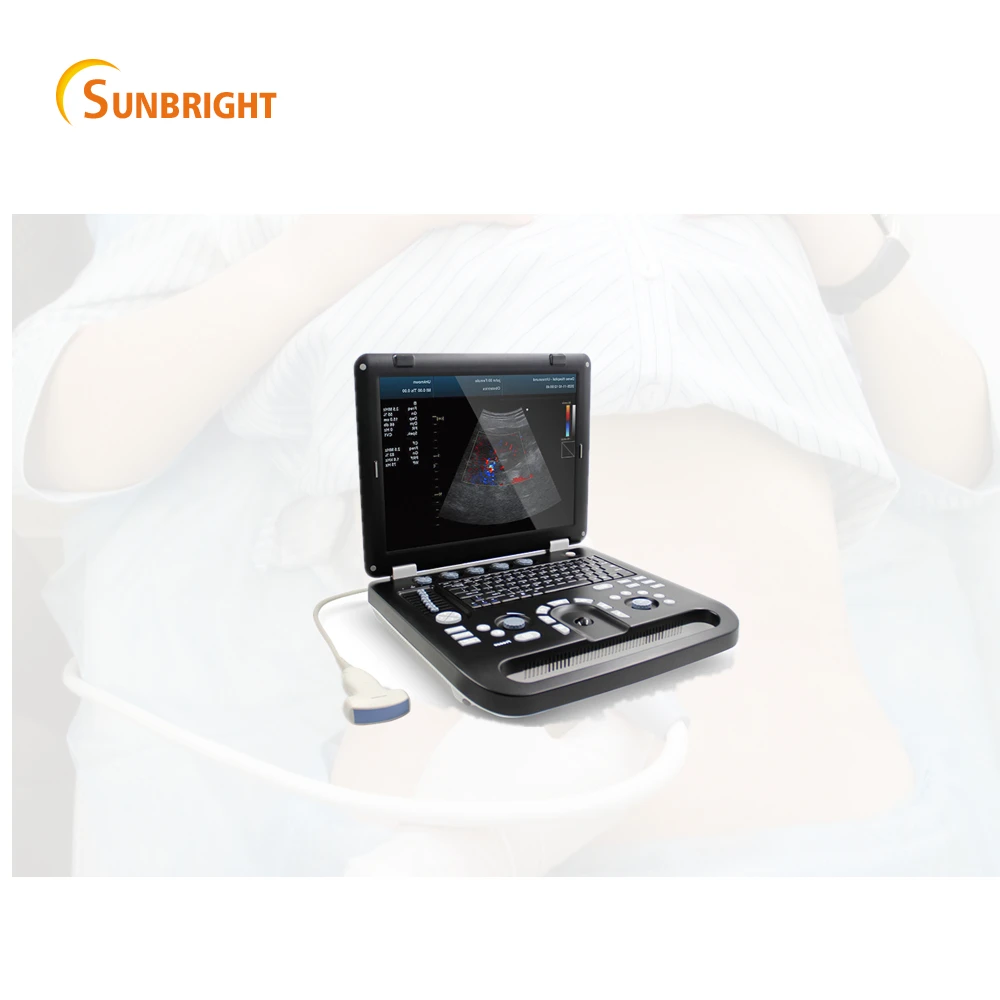 

Quality Ideal sunbright high quality color doppler with 3D 4D ultrasound instrument cheap