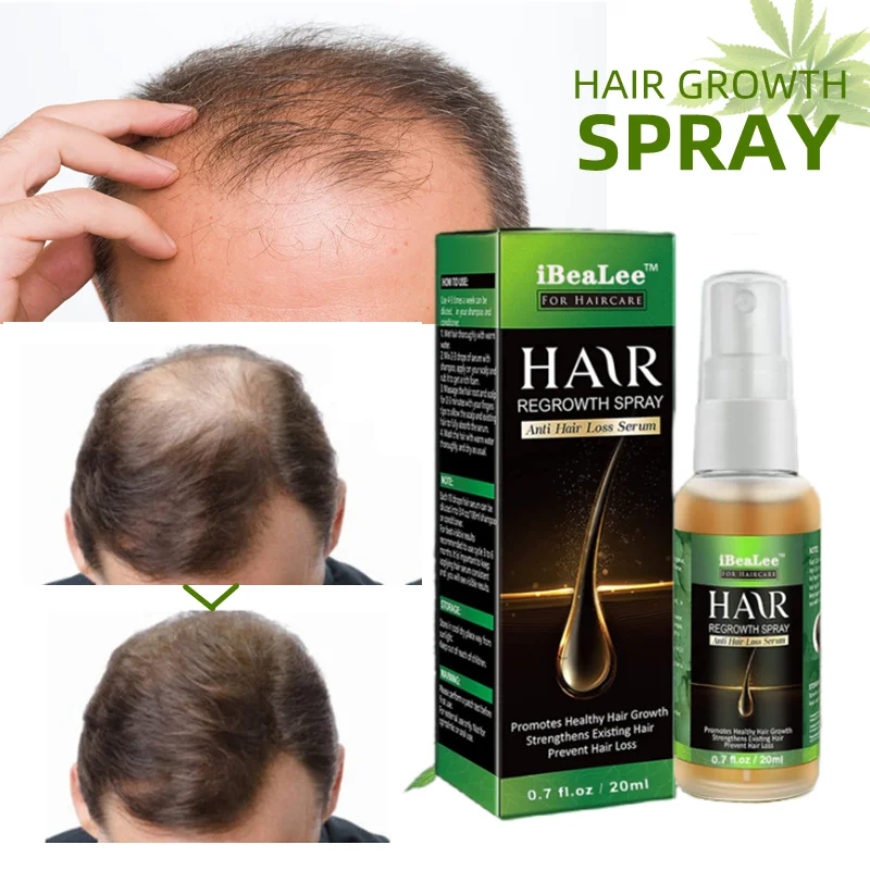 Ginger Hair Growth Spray Fast Growing Serum Prevent Hair Loss Essence Anti Loss Scalp Treatment Care Product Men Women 20ml