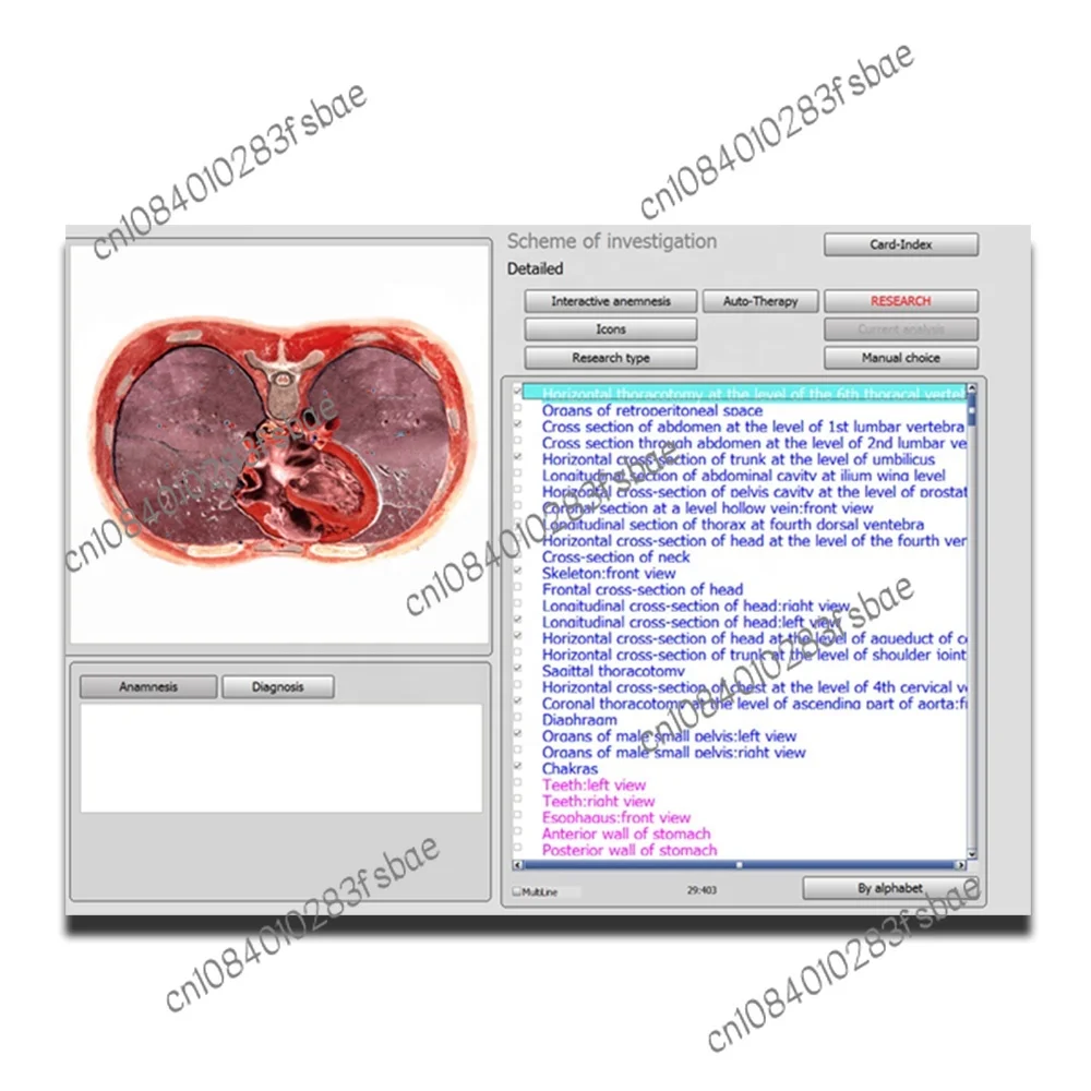 Квантовый резонанс 17d 18d 25d NLS автоматический клинический химический анализатор