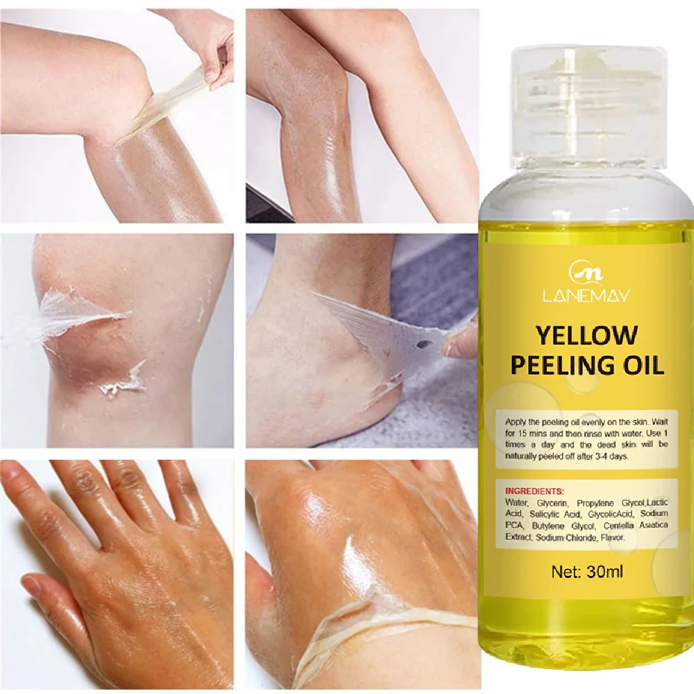 

Yellow Peeling Oil Bleaching Dark Skin Spots Remove Dead Skin Lighten Melanin Scrub Exfoliating Whiten Moisturize Body Skin Care